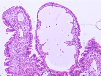 lymphangiectasia, jejunum, dog.