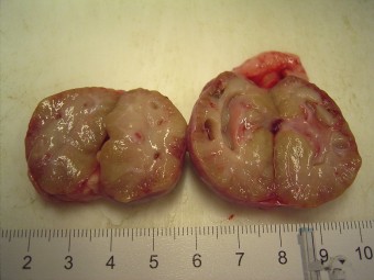 chronic interstitial nephritis with cysts, cat