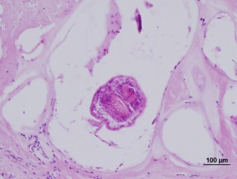 Echinococcus multiloculairs, dog, liver