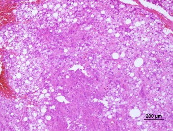 liposarcoma,dog