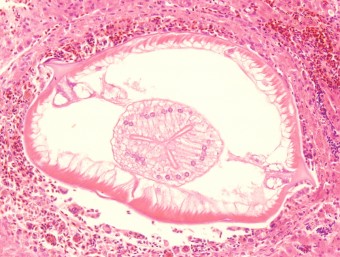 liver nematode, parrot