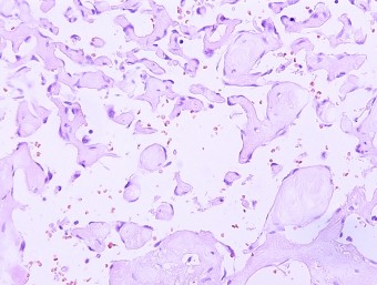 lymphangioma, skin, dog