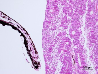 meduloepithelioma, dog