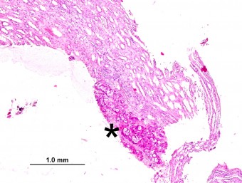 meta carcinoma, kidney, core biopsy,dog