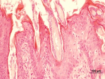 Microsporum canis on the hairs