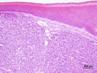 oral plasma cell tumor, dog