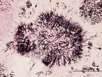 pulmonary aspergilosis, parrot, grocott