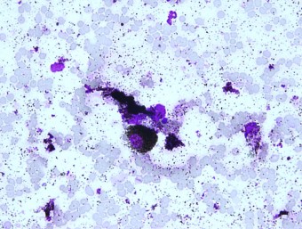 subungual melanoma, rabbit, FNAB