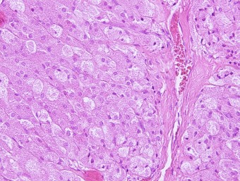 tumor of Leydign cells, rabbit