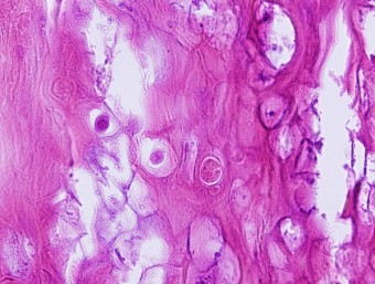 viral papilloma, dog, intranuclear inclusions