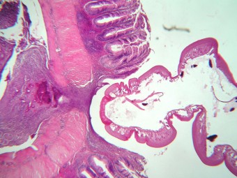 Bothriocephalus acheilognathi, chub, intestine