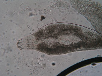 Dactylogyrus with egg