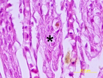 KHV inclusions in the gill epithelium