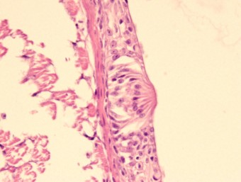 neuromasts of the lateral line, com. carp