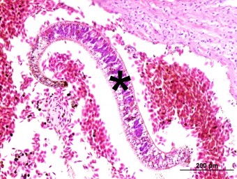 Sanguinicola head kidney com. carp