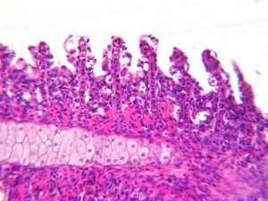 hyperplasia of chloride cells (EGC), gills, com. carp